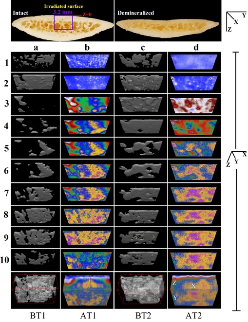 Photothermal Coherence Imaging